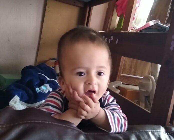 Elías es un bebé con hidrocefalia