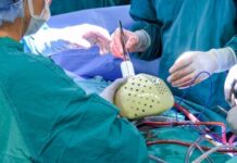 Implantan primer corazón artificial en Estados Unidos. Implantan primer corazón artificial en Estados Unidos
