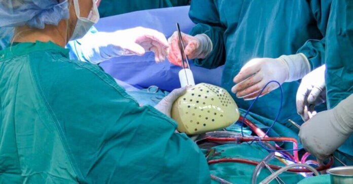 Implantan primer corazón artificial en Estados Unidos Implantan primer corazón artificial en Estados Unidos