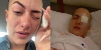 VIDEO: Mujer se echa ‘Kola Loka’ en los ojos, pensó que eran sus gotas. TikToker se pone pegamento en el ojo
