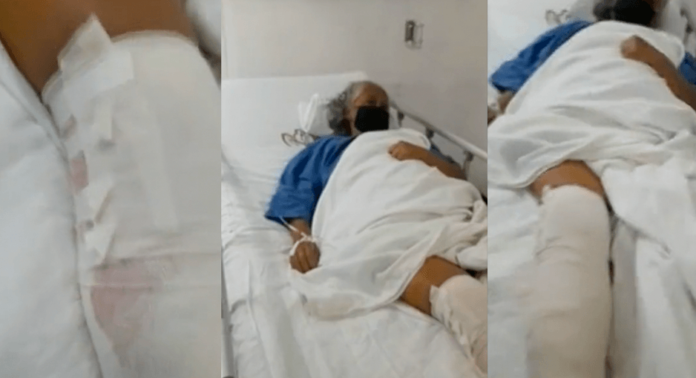 Le operaron la pierna equivocada en el Issste de San Luis Potosí