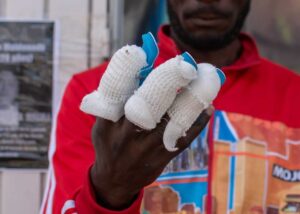 Haitiano se fracturó dedos en Tijuana