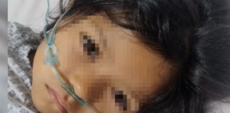 Hemorragia en menor de Rosarito podría no estar relacionada a su caída en kínder.