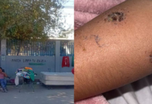 Alumna de Tijuana no fue picada por araña violinista: Secretaría de Educación.