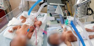 Cuatro niños con VIH fueron adoptados en lo que va de 2025 en Tijuana.