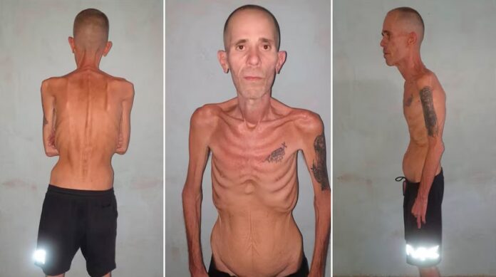 Preso político Cuba